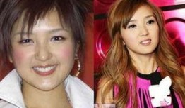 爆料明星整容是谁啊视频,视频爆料明星整容真相，究竟是谁在背后动刀？